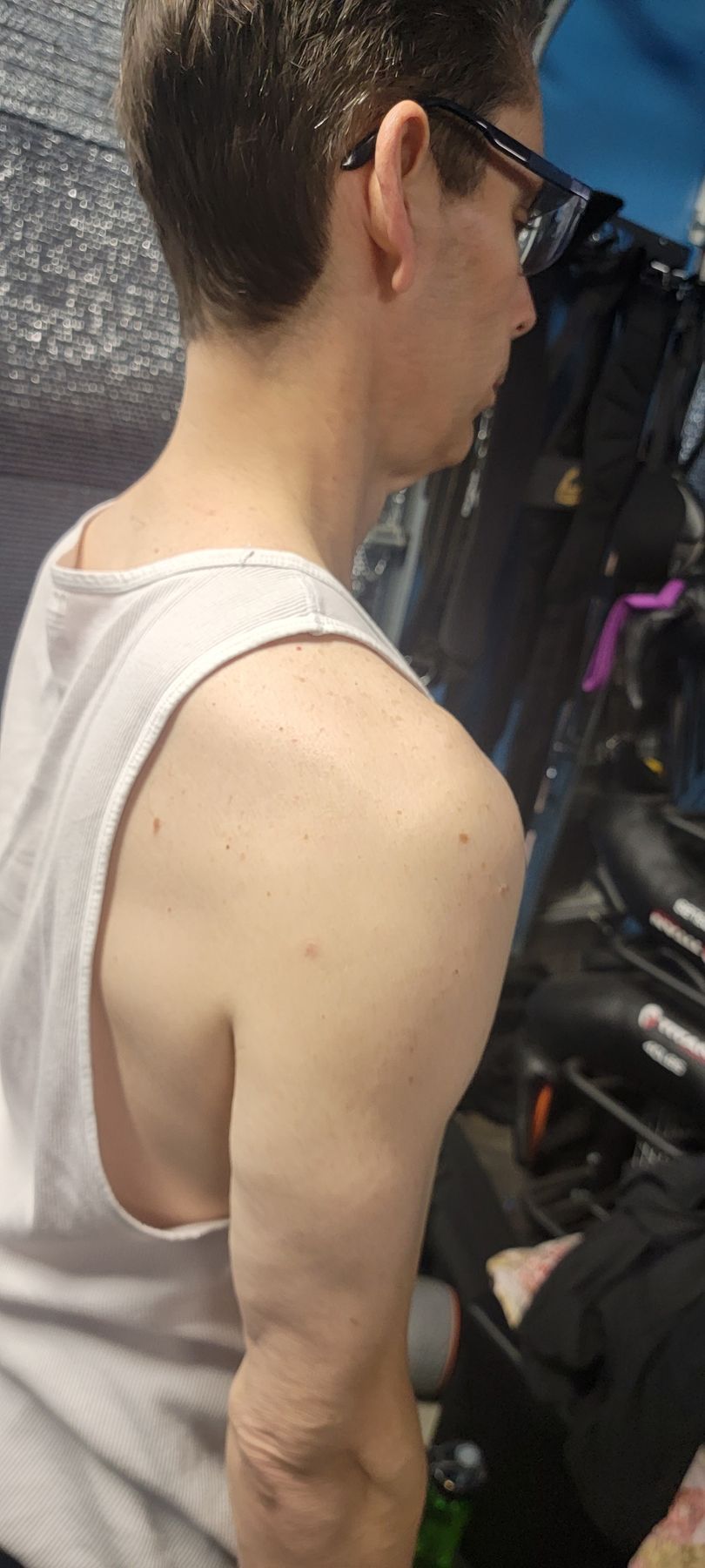 Side profile of a man’s shoulder and upper back in a tank top and glasses, highlighting scapular and shoulder posture for progress tracking.