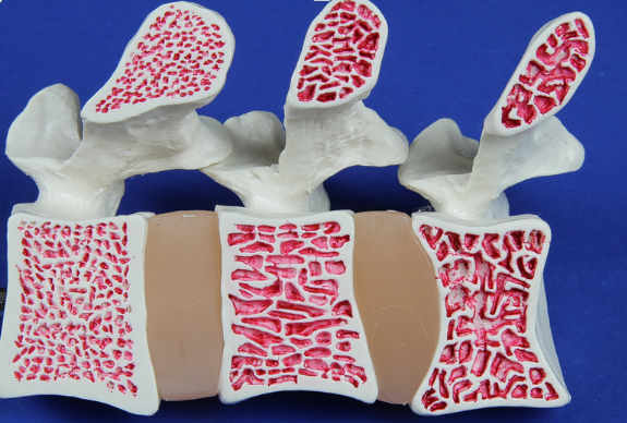 An anatomical model showing cross-sections of vertebral bones with red marrow details on a blue background