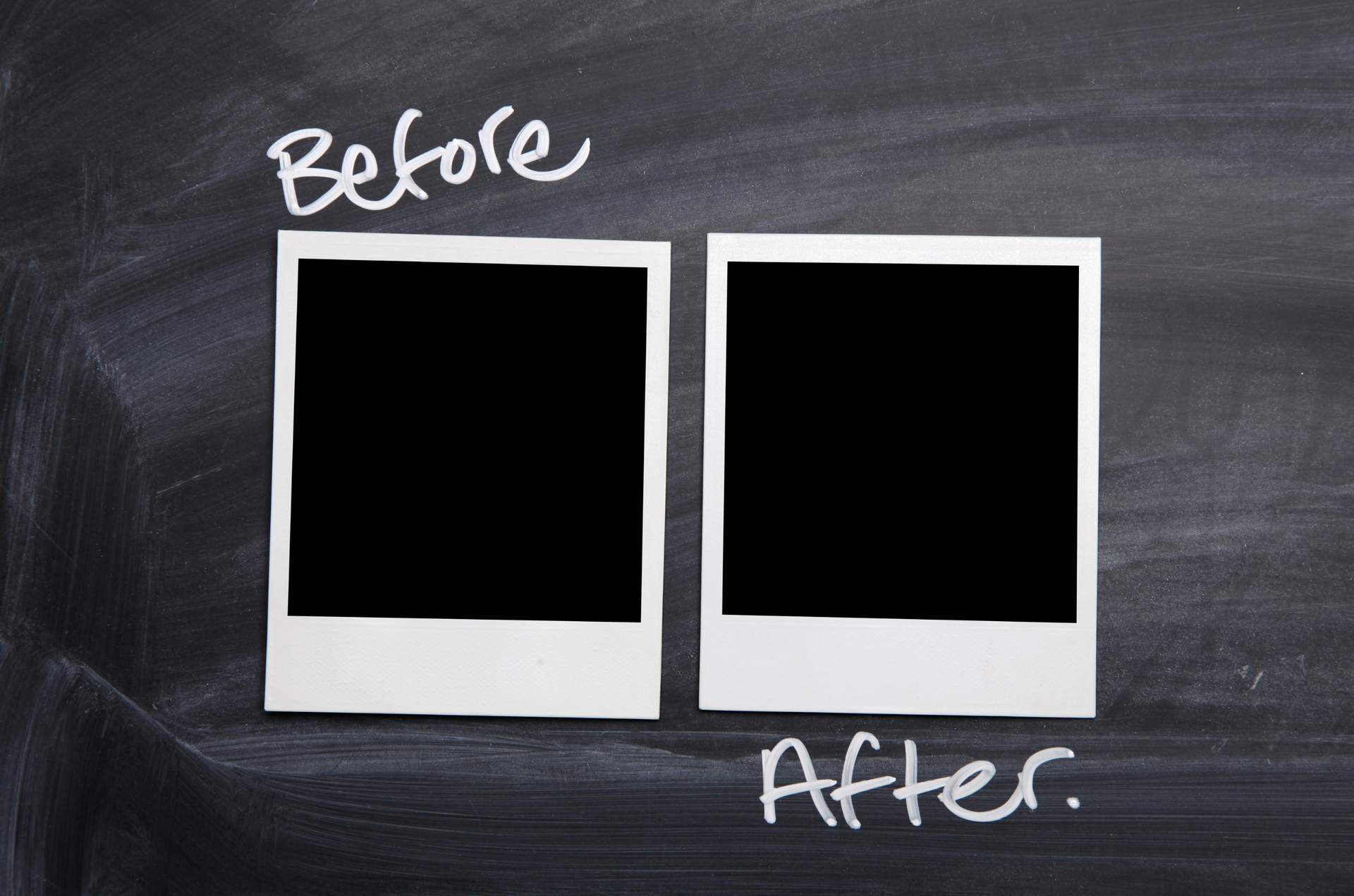 Chalkboard with two blank Polaroid frames labeled ‘Before’ and ‘After.’