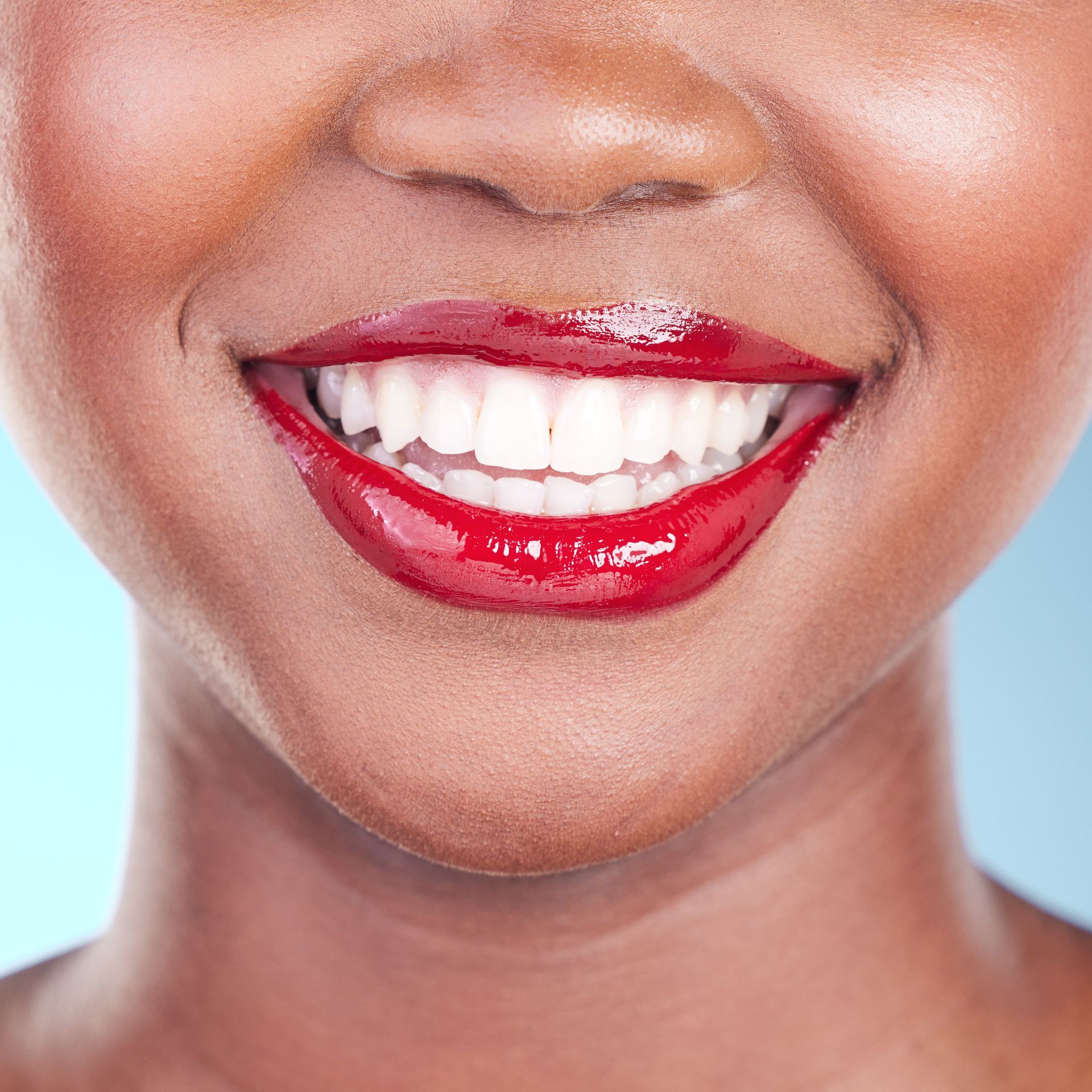 Woman with bright white teeth | Get professional teeth whitening in Davenport, FL.
