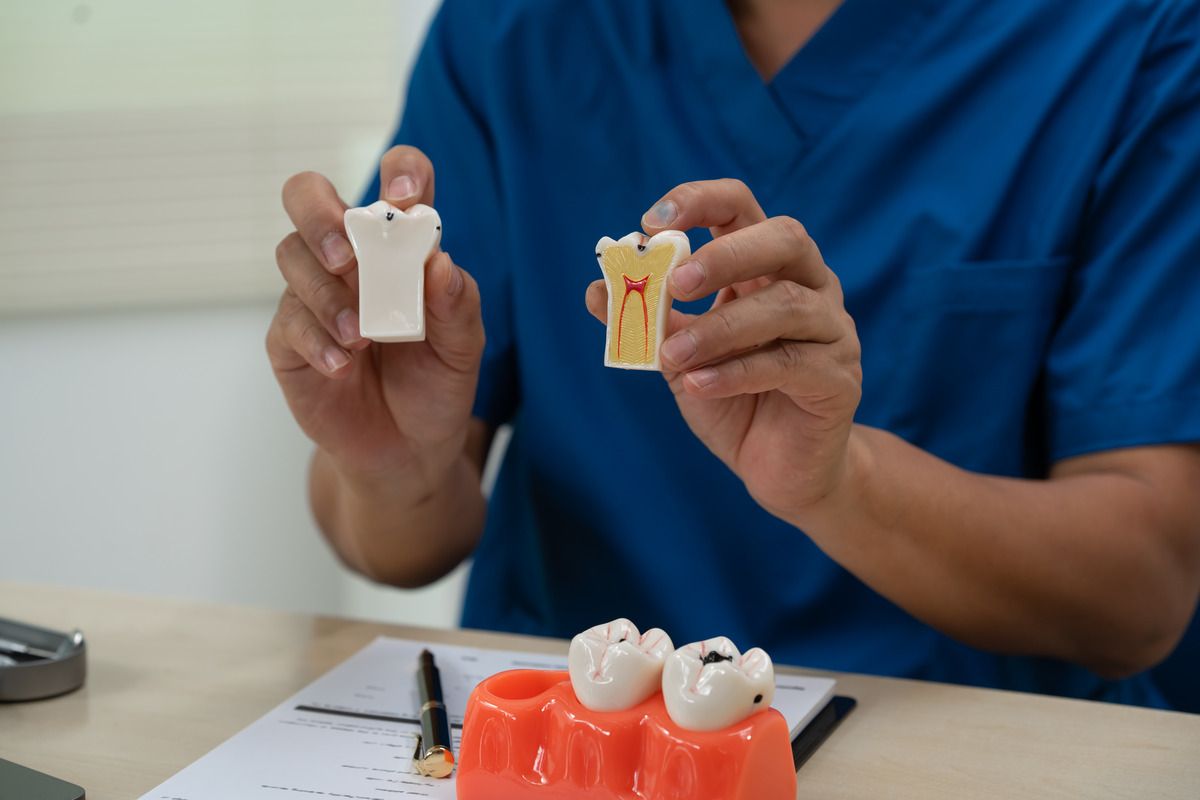 A dentist is holding a model of a tooth with a hole in it.