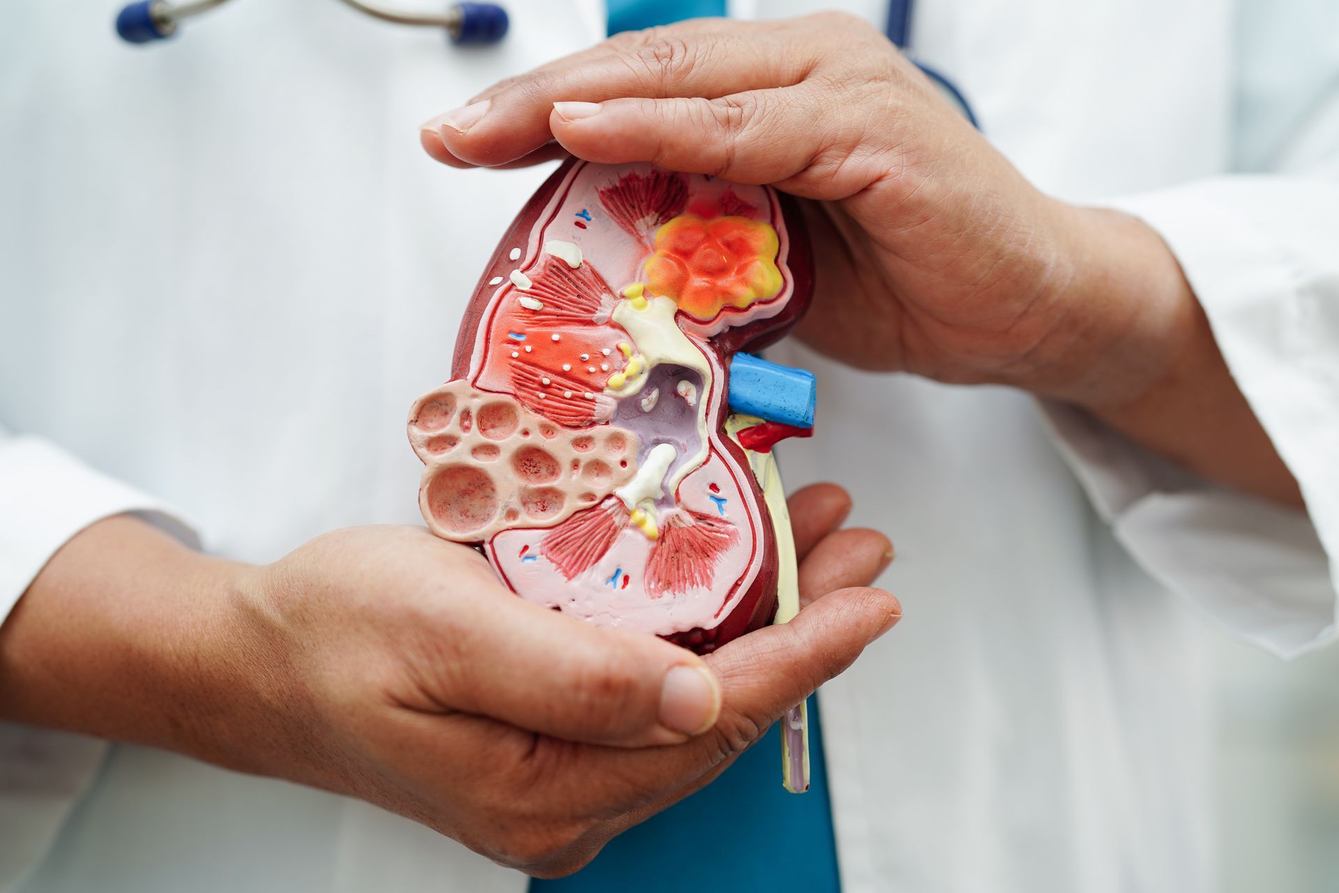 Doctor holding a detailed anatomical model of a human kidney.