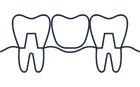 Partial Dentures