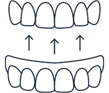 Denture Repairs & Relines