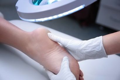 dottore mani con guanti mentre lavora per dermatologo di piede con paziente