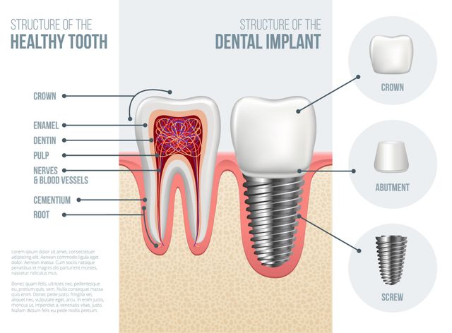 Premium Periodontics & Dental Implants