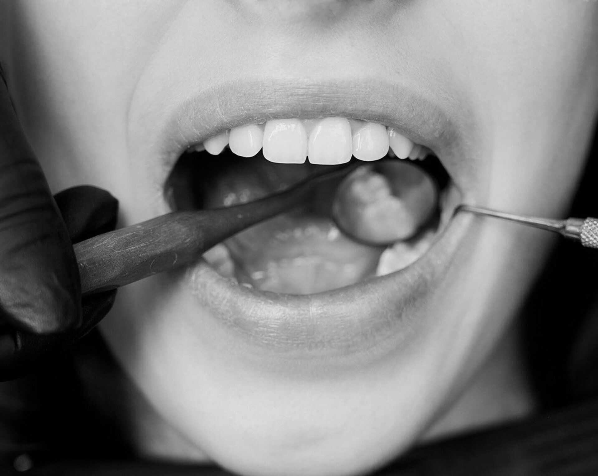 A black and white photo of a person getting their teeth examined by a dentist.