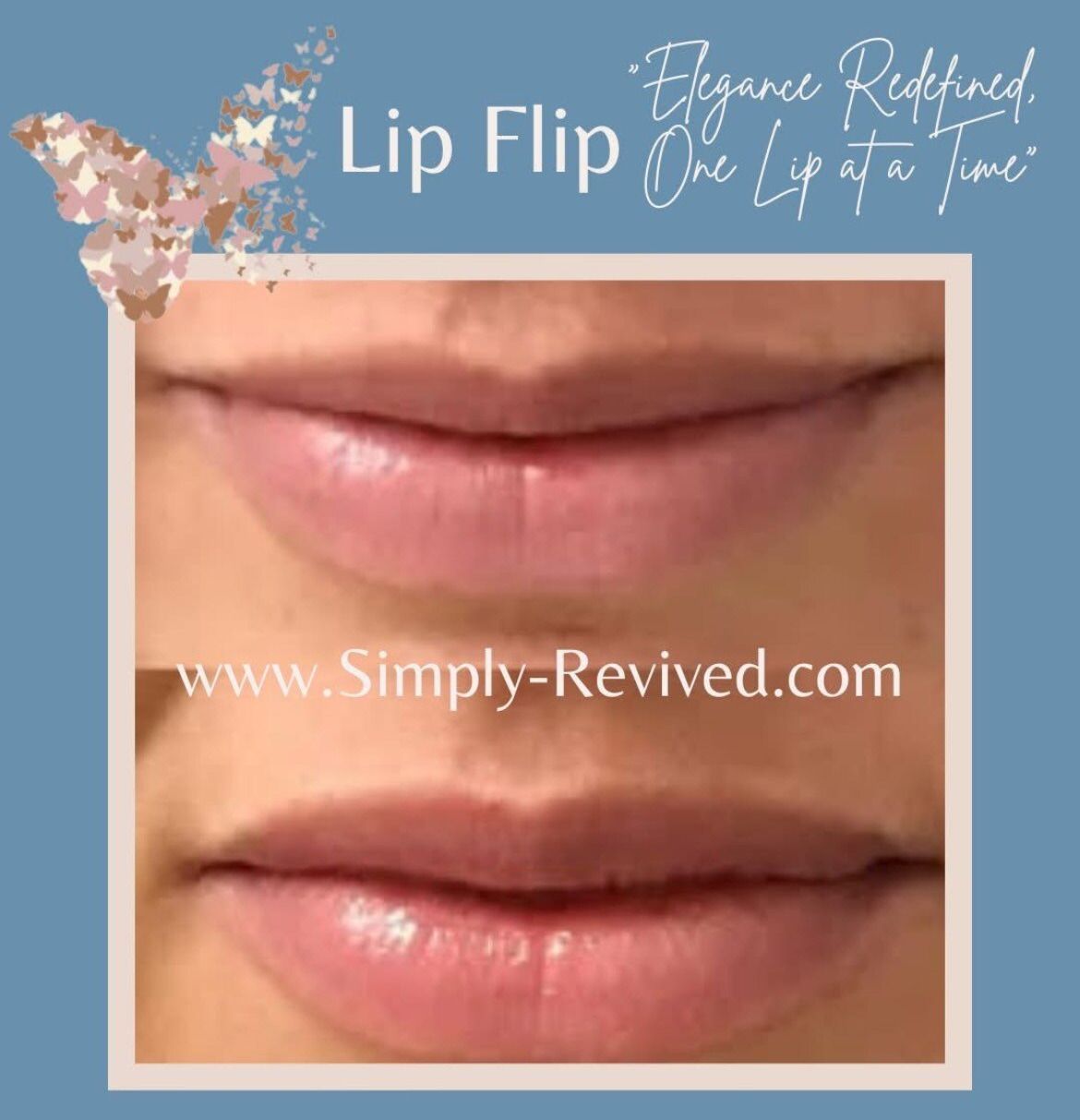 Before and after comparison of lips; upper lip appears fuller in the after photo. Blue background with text