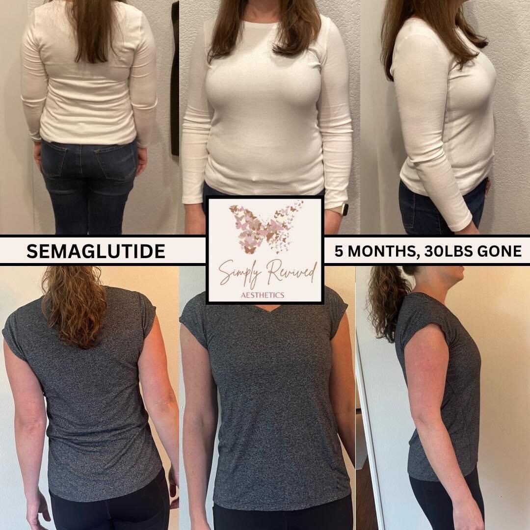 Before-and-after photos of a person wearing white and gray tops and jeans. Weight loss results from Semaglutide in 5 months.