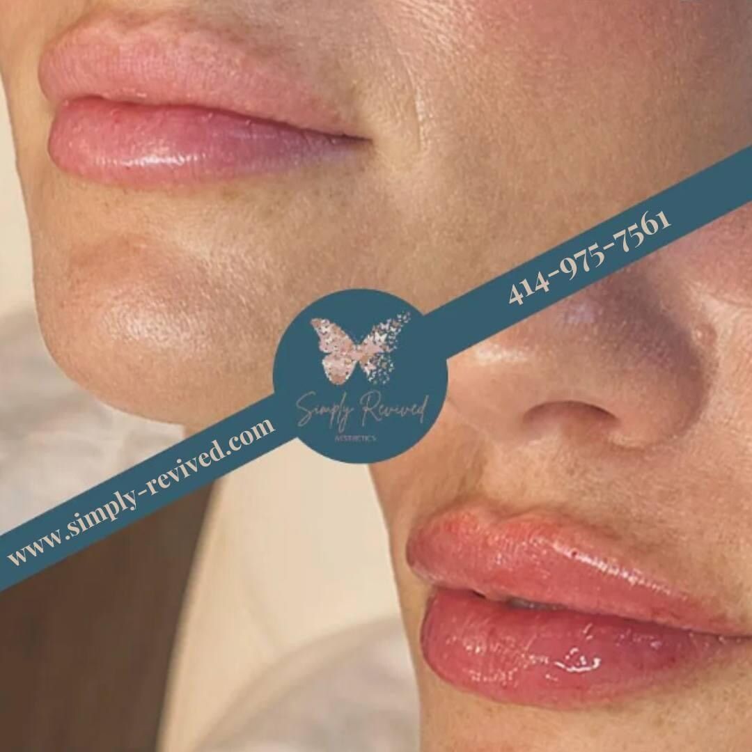 Before and after lip enhancement. Top: thinner lips. Bottom: fuller, pink lips. Website and phone number overlay.