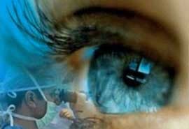 OFTALMOLOGÍA DIABÉTICA - Catarata