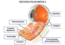 OFTALMOLOGÍA DIABÉTICA - Campimetría