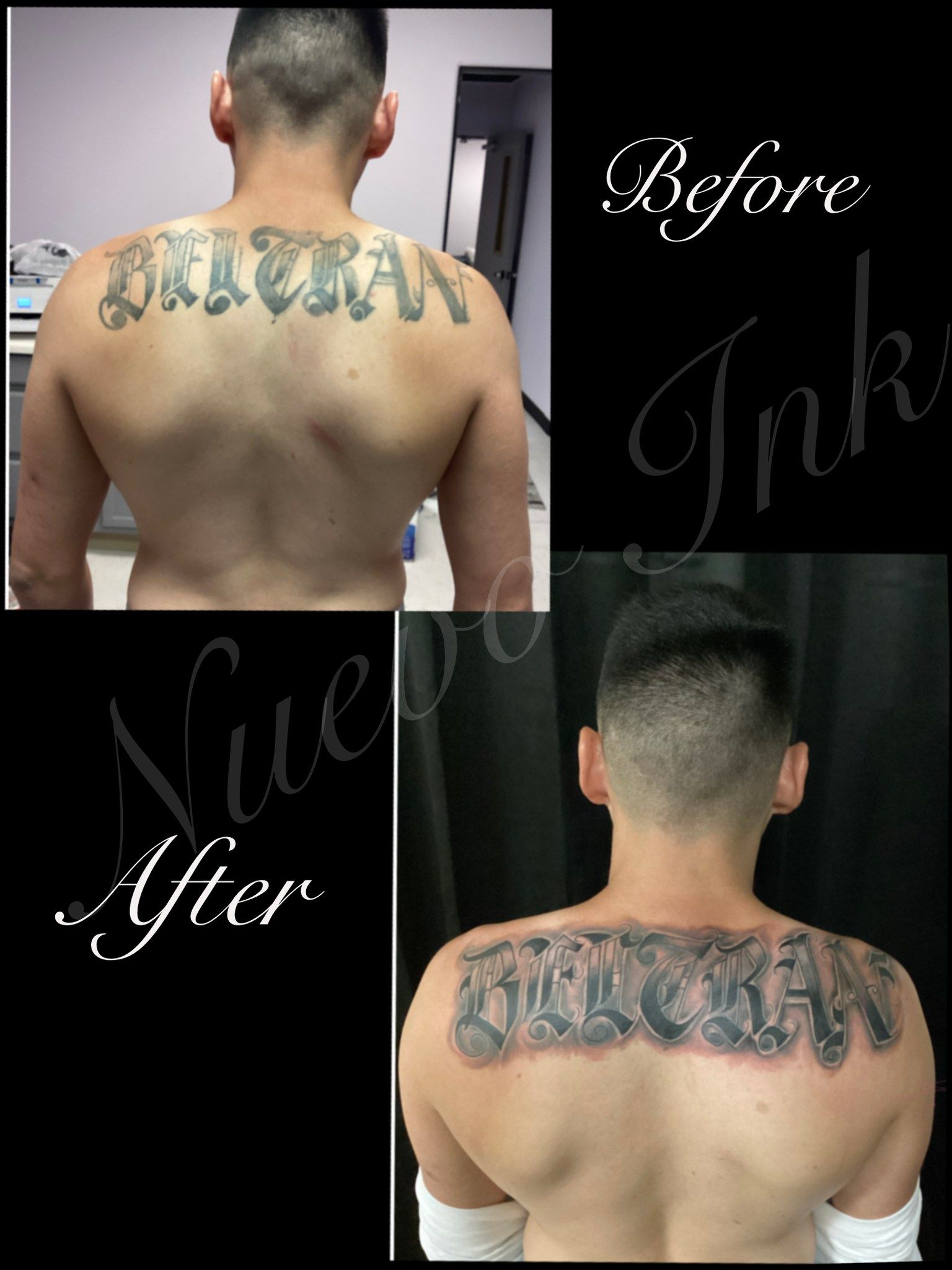 Before and after tattoo removal on a man's back. The original tattoo reads 