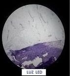 Vista microscópica de una muestra de tejido teñida de color púrpura.