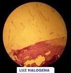 Vista microscópica de tejido, principalmente amarillo con una sección teñida de rojo en la parte inferior; etiquetada 