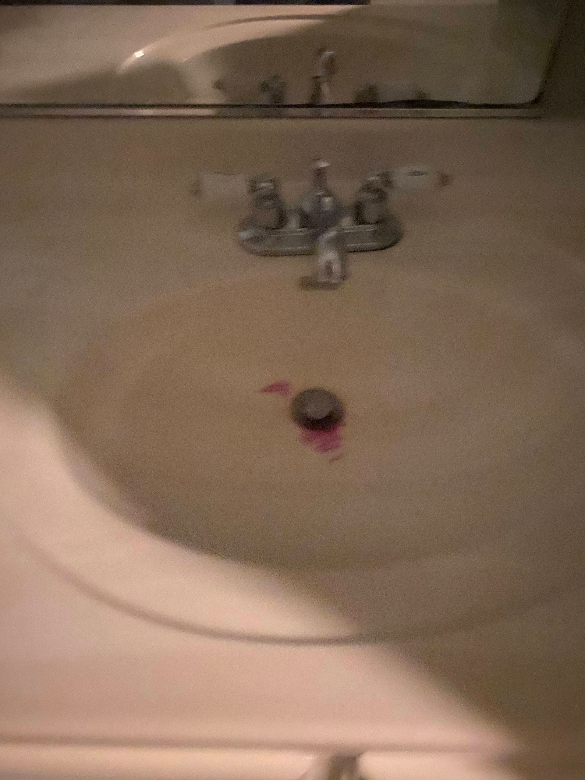 White bathroom sink with pink stain around the drain and chrome faucet.