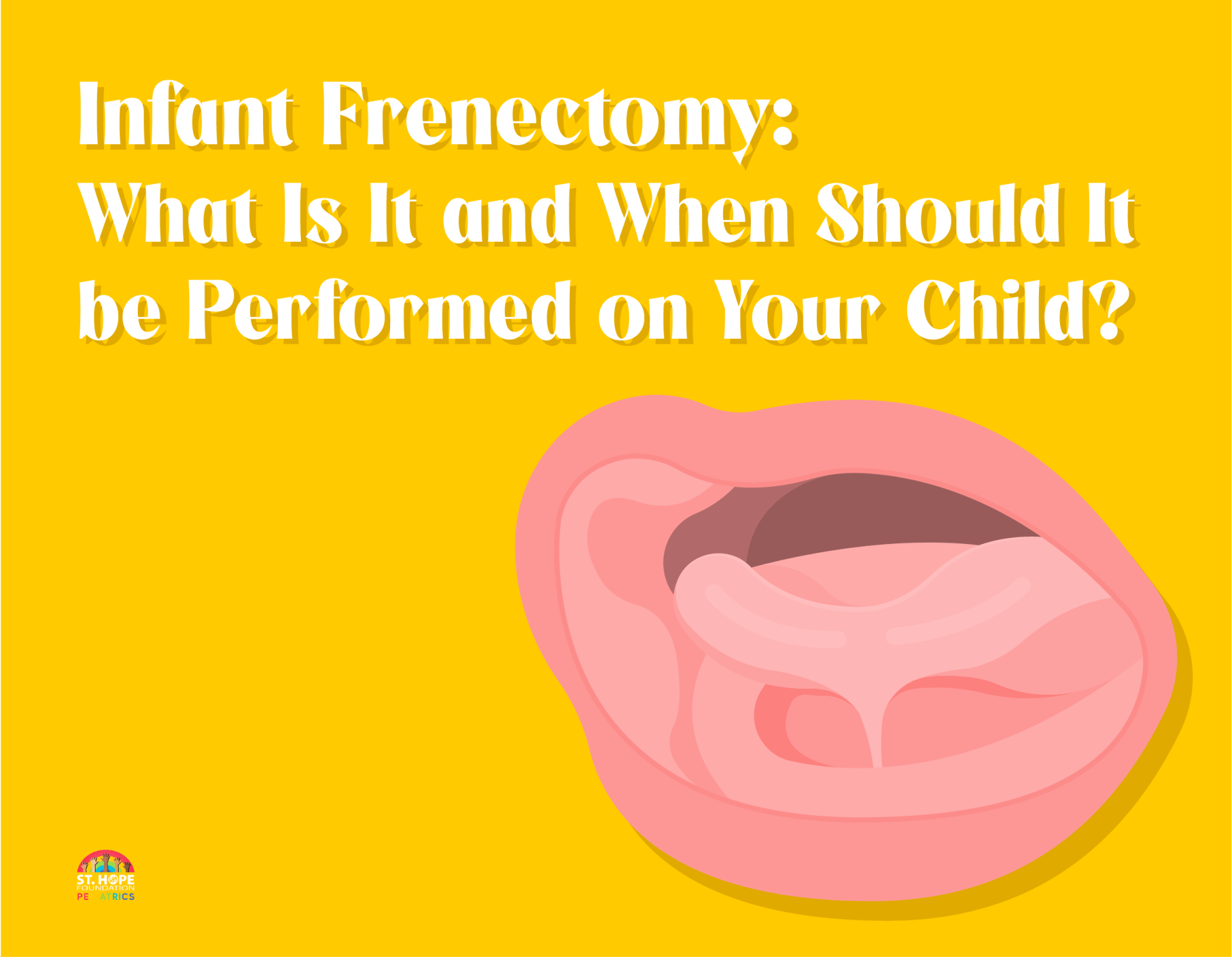 What is a frenectomy?