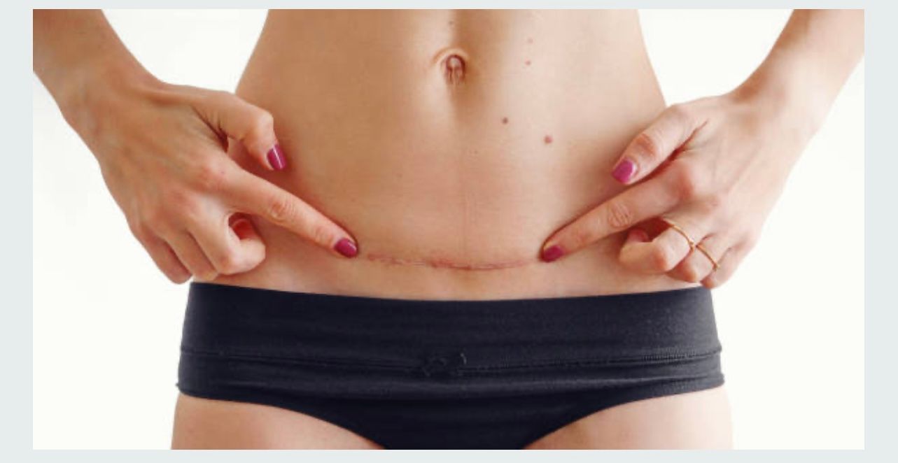 Woman's Hip — Medford, NJ — A to Zen Bodyworks Healing Spa