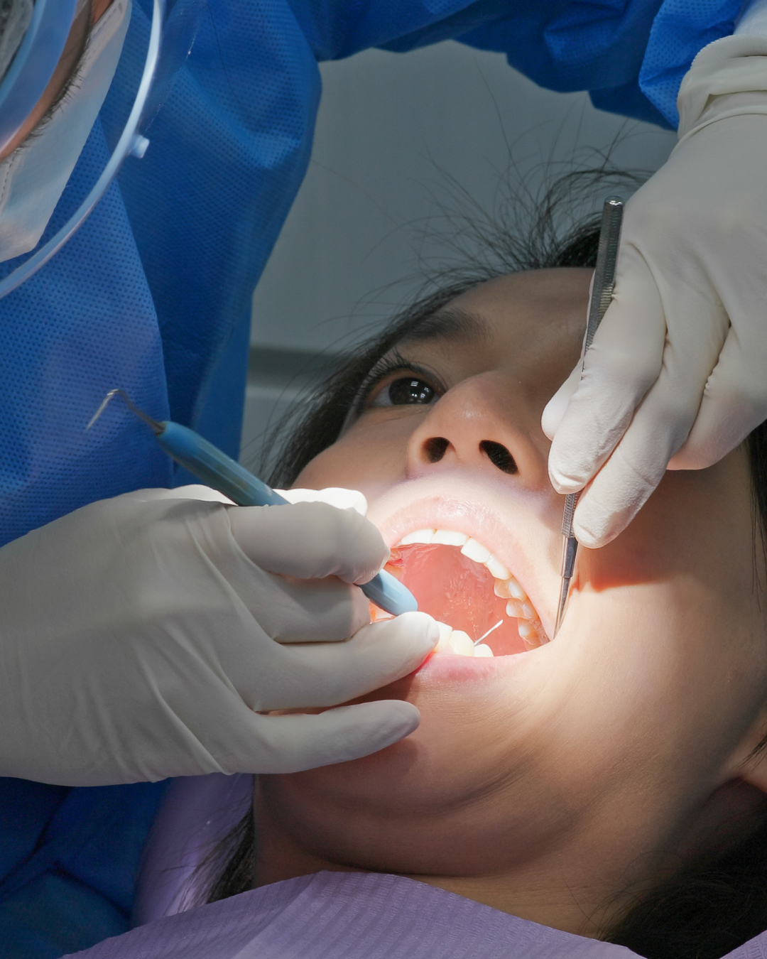 Un dentiste examine la bouche ouverte d'un patient à l'aide d'instruments dentaires. 