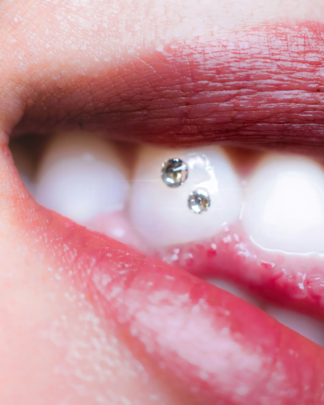 Gros plan sur une bouche ornée de deux pierres précieuses étincelantes fixées à une dent blanche.