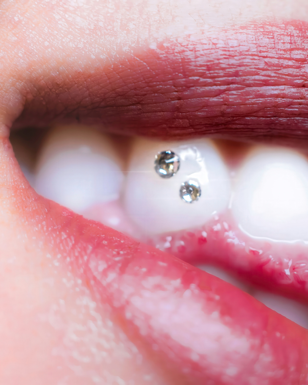 Gros plan sur une bouche avec du rouge à lèvres rouge foncé et deux bijoux scintillants collés sur une dent.