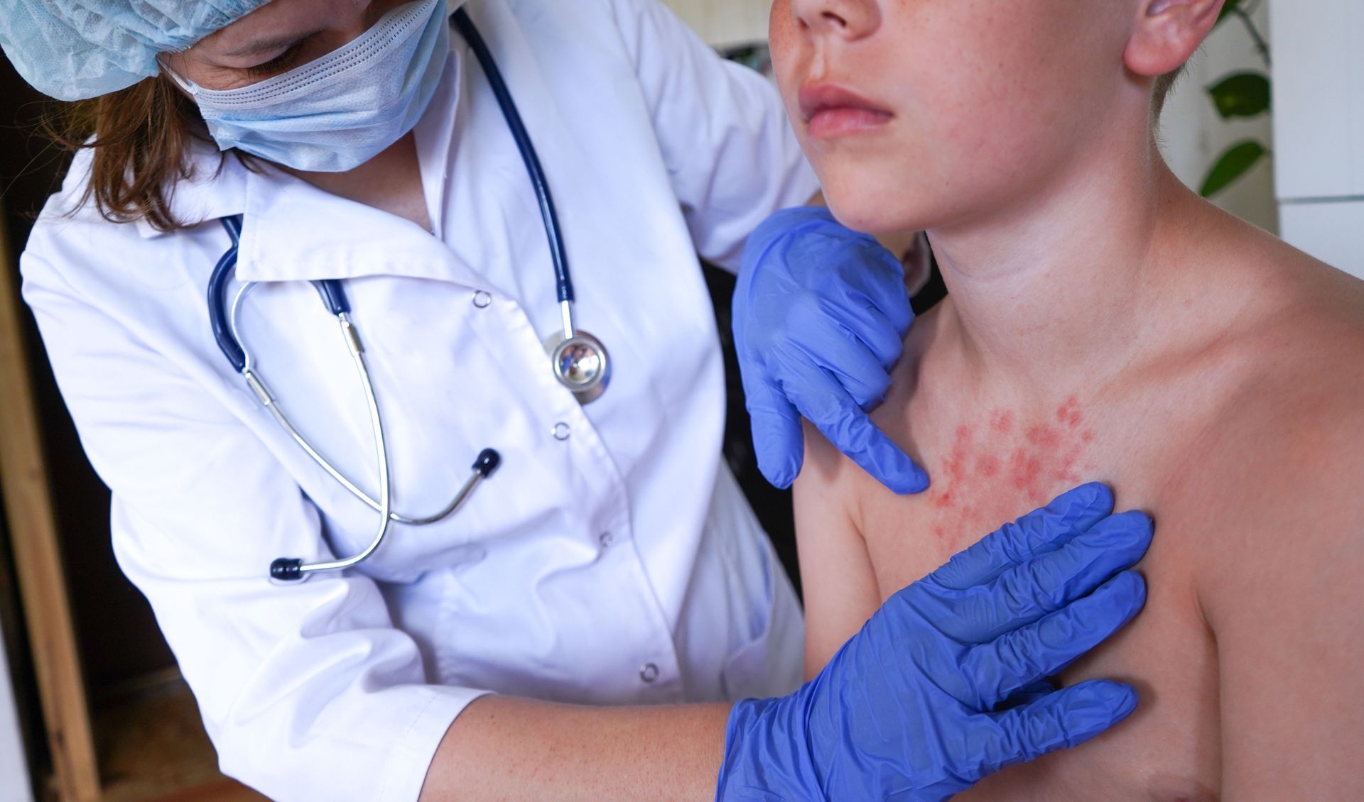 A dermatologist is checking a kid’s skin.
