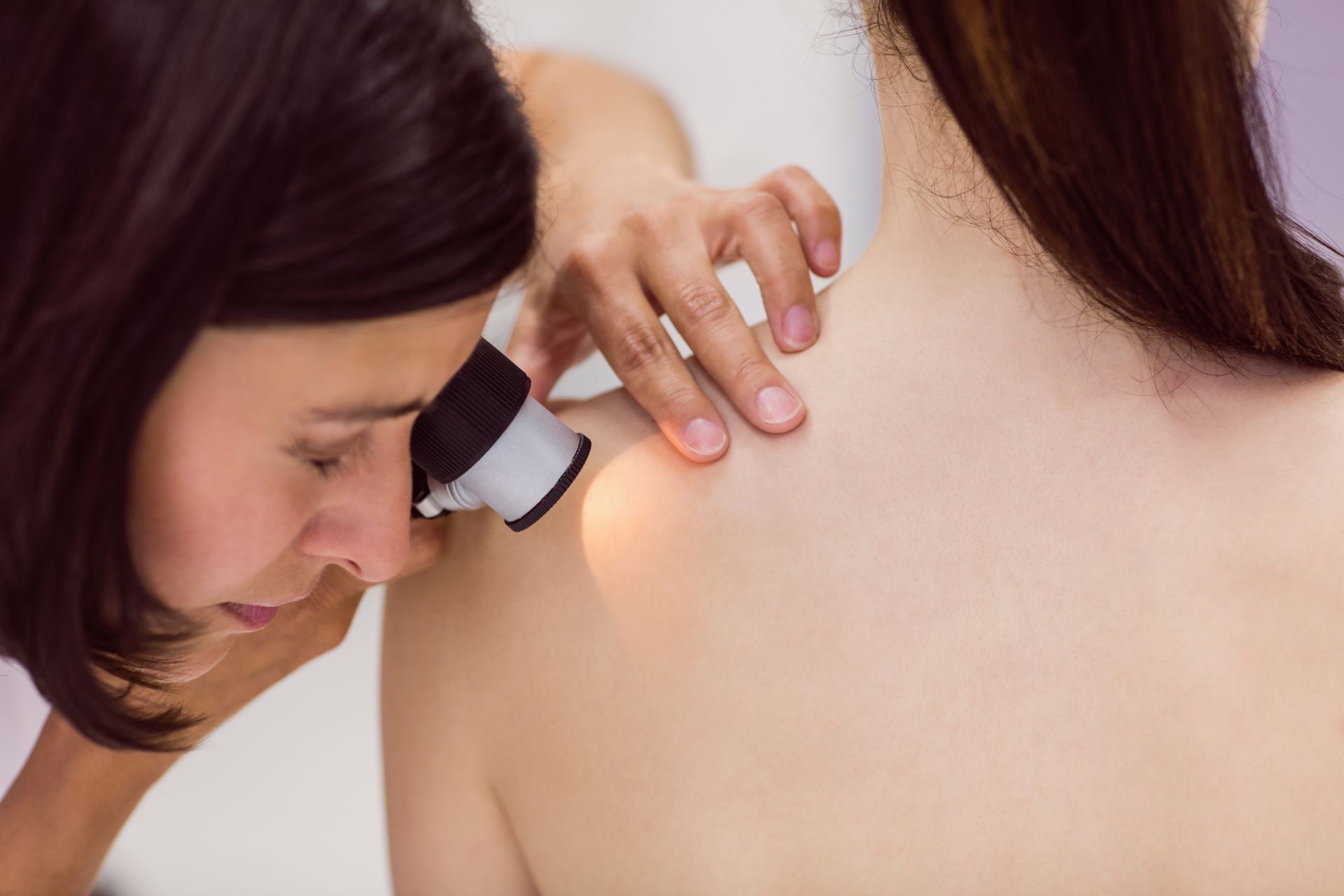 Person examining a mole on another person's bare shoulder with a dermatoscope