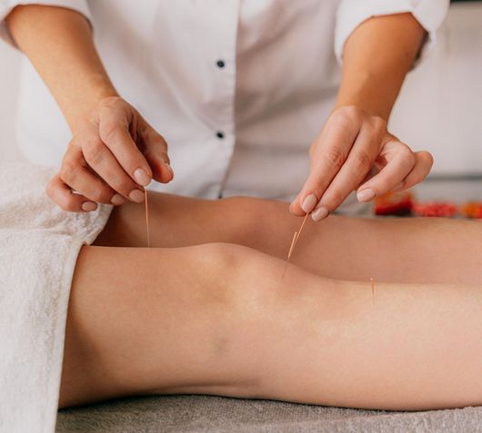 Person receiving acupuncture on their knee; hands holding needles.