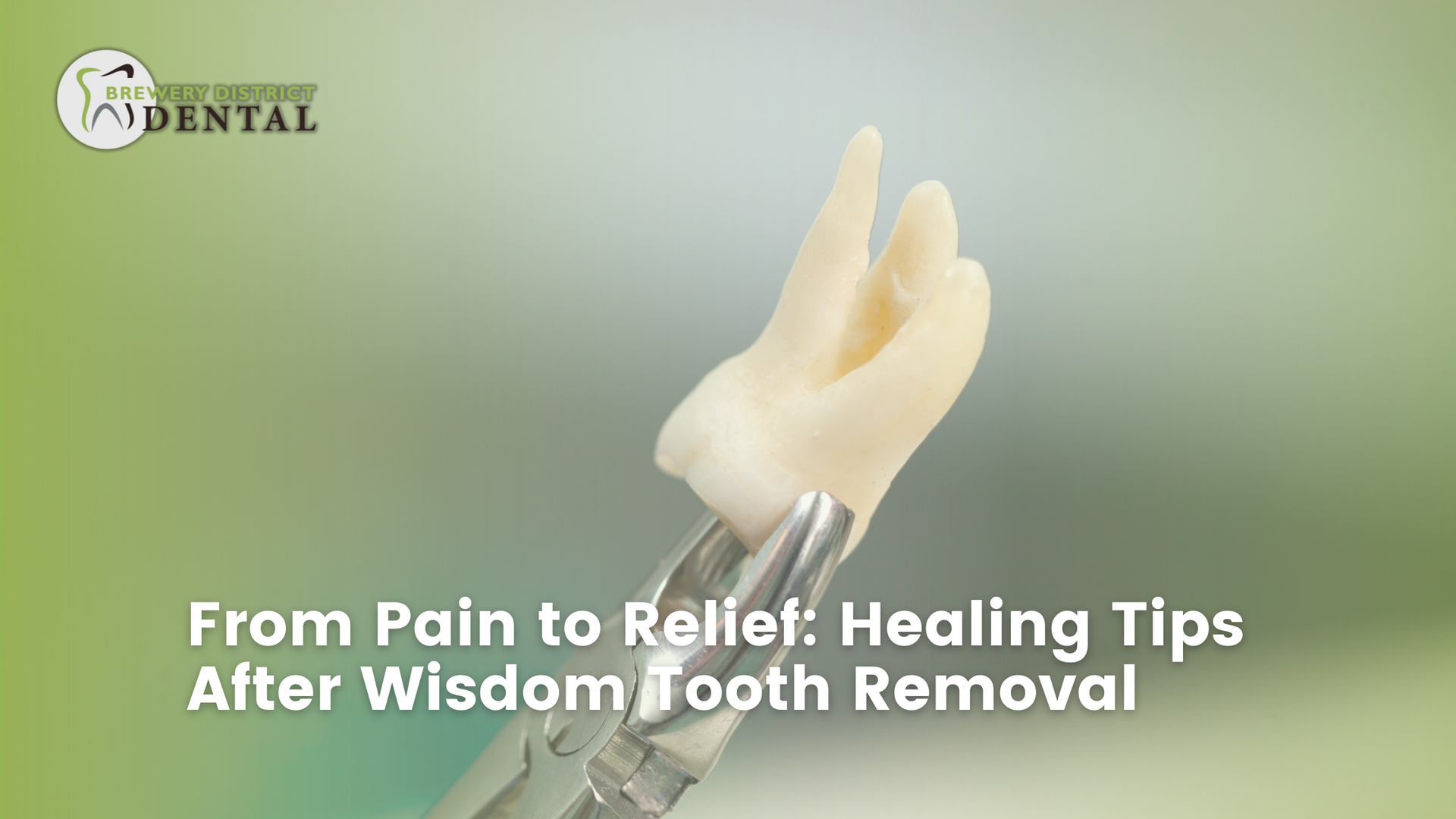 From pain to relief : healing tips after wisdom tooth removal