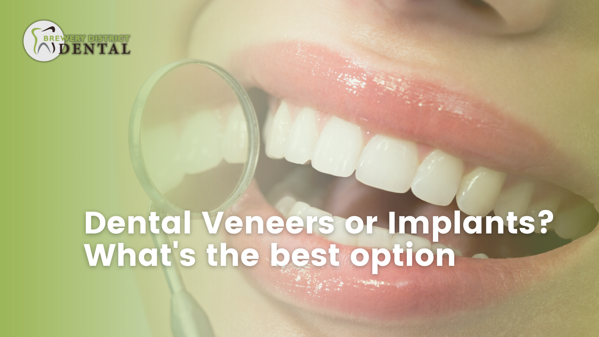 Straight beautiful teeth with mirror and title Dental Veneers or Implants? What's The Best Option