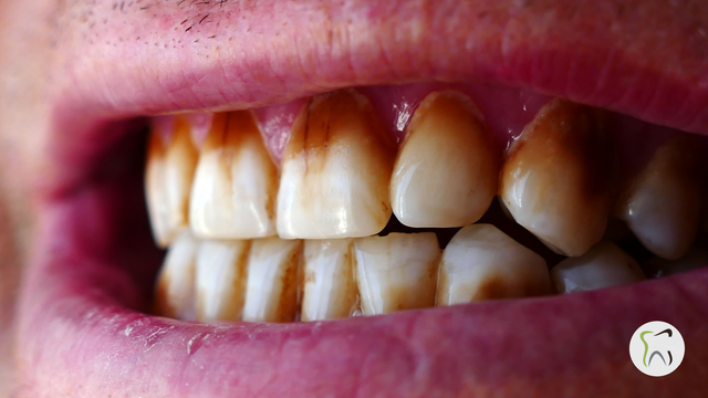 How Smoking and Vaping Affect Your Oral Health