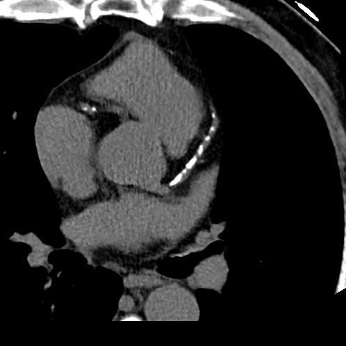 Doctor in scrubs showing heart diagram on tablet to patient in hospital room.