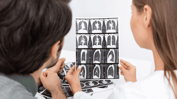A doctor and a patient reviewing lung X-ray images together.