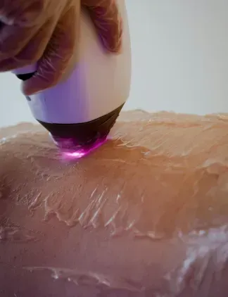 Hand using a handheld device with a purple light on dry skin during treatment