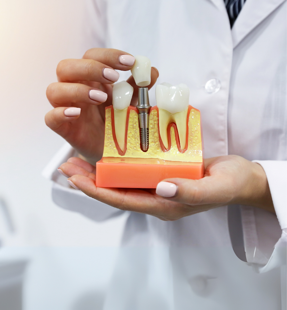 Dentist holding a dental model with teeth, roots, and an implant illustration