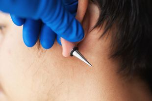 A close up of a person getting a piercing in their ear.