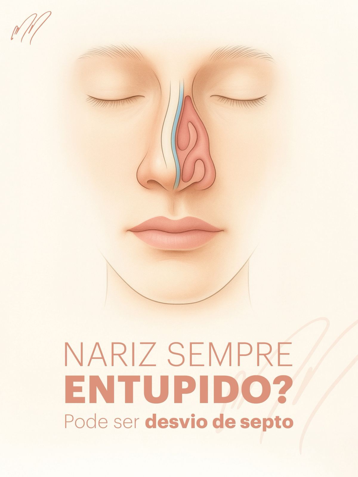 desvio de septo nasal