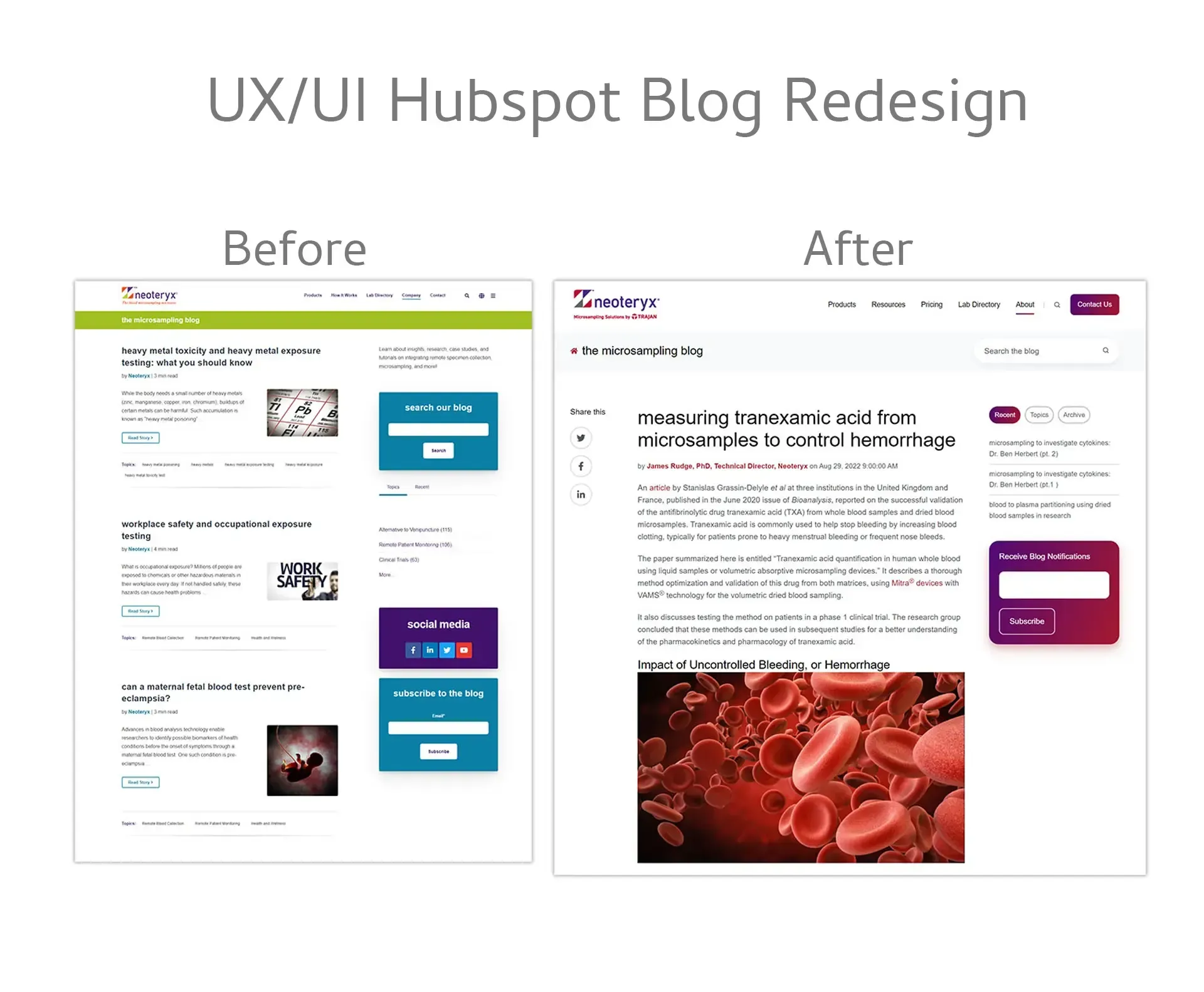 UX/UI redesign comparison of HubSpot blog, showing