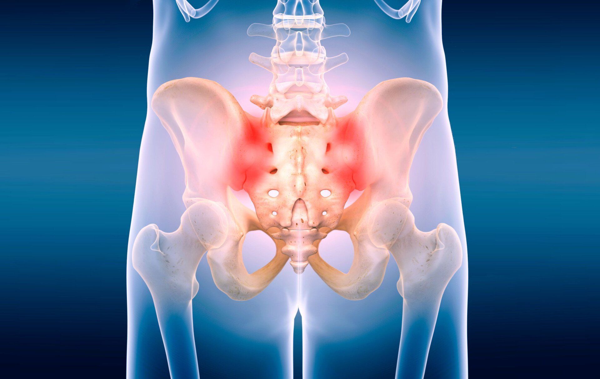 Sacroiliac Joint Pain SI Joint Pain Sacroiliac Joint Pain SI Joint Pain