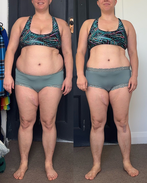 Alexa, before and after