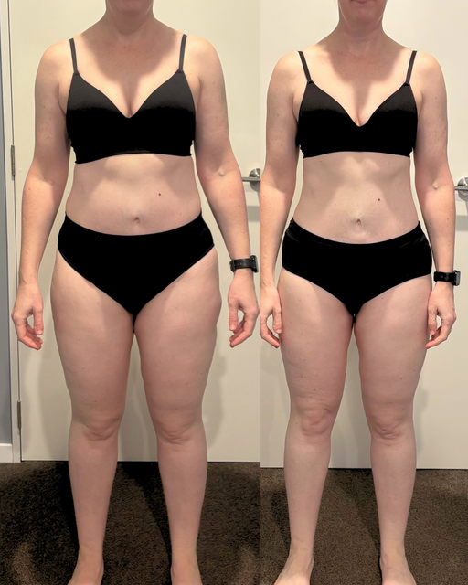 Shelley, before and after