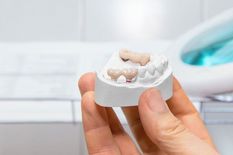 Hand holding a dental model with bridge and crown. White background, dental lab setting.