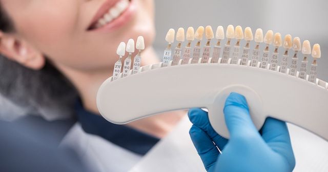 Dental Veneers near Me: Your Perfect Smile Solution