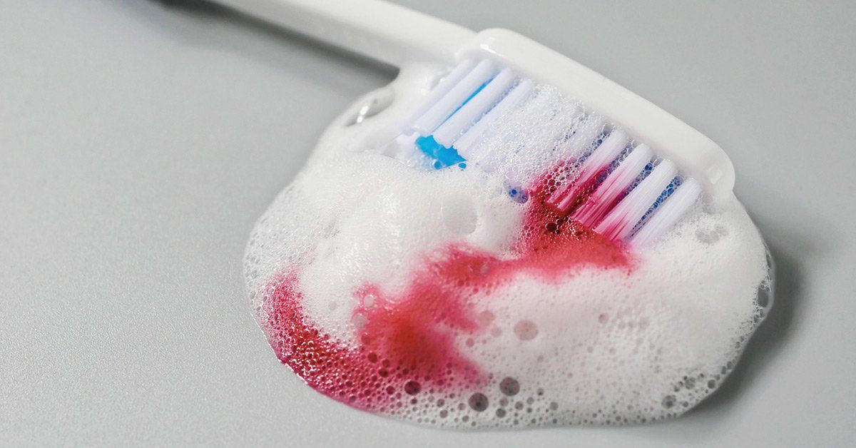 how to stop gum bleeding