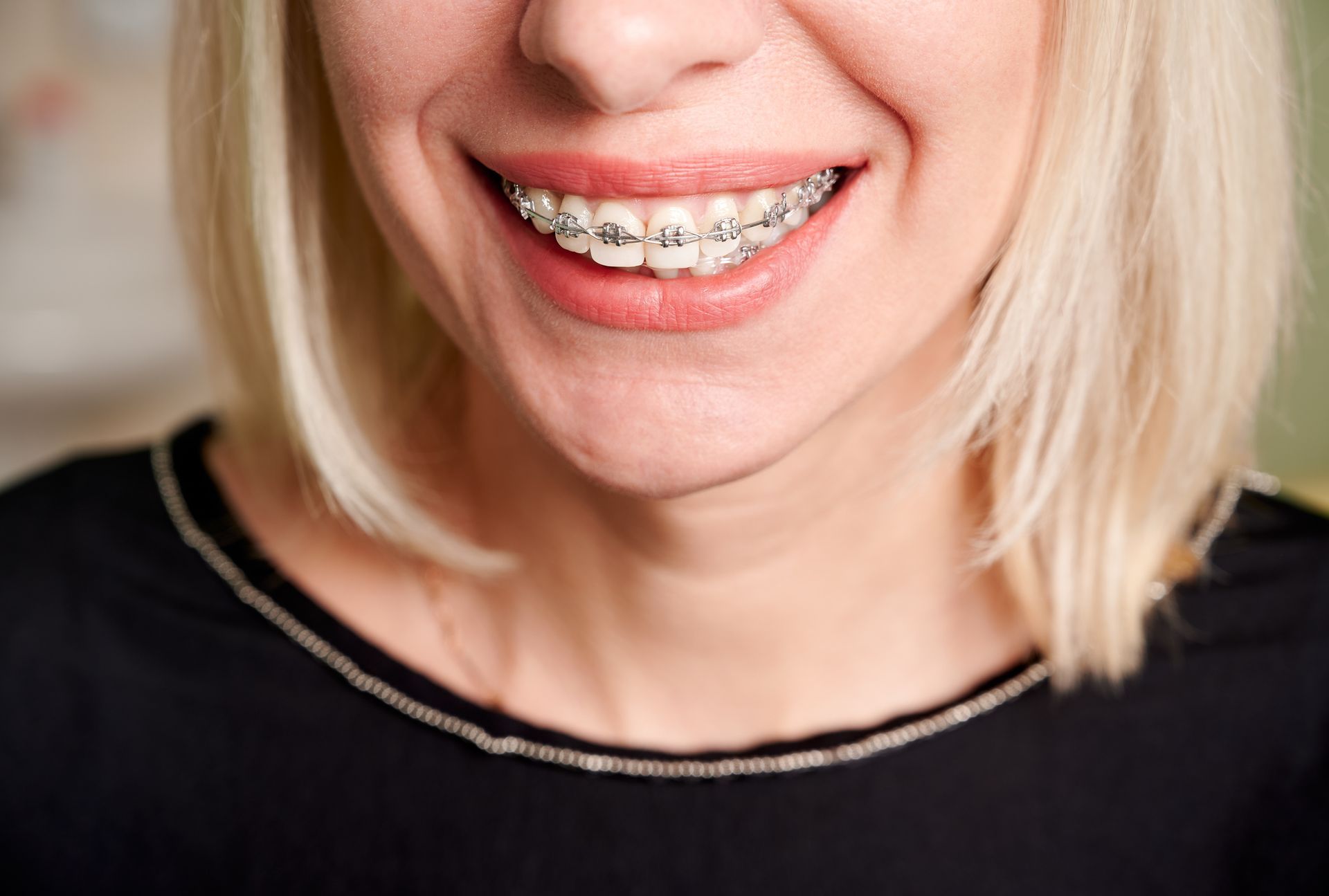 Close-up of a blonde woman smiling, showing her teeth with metal braces. She wears a black top.