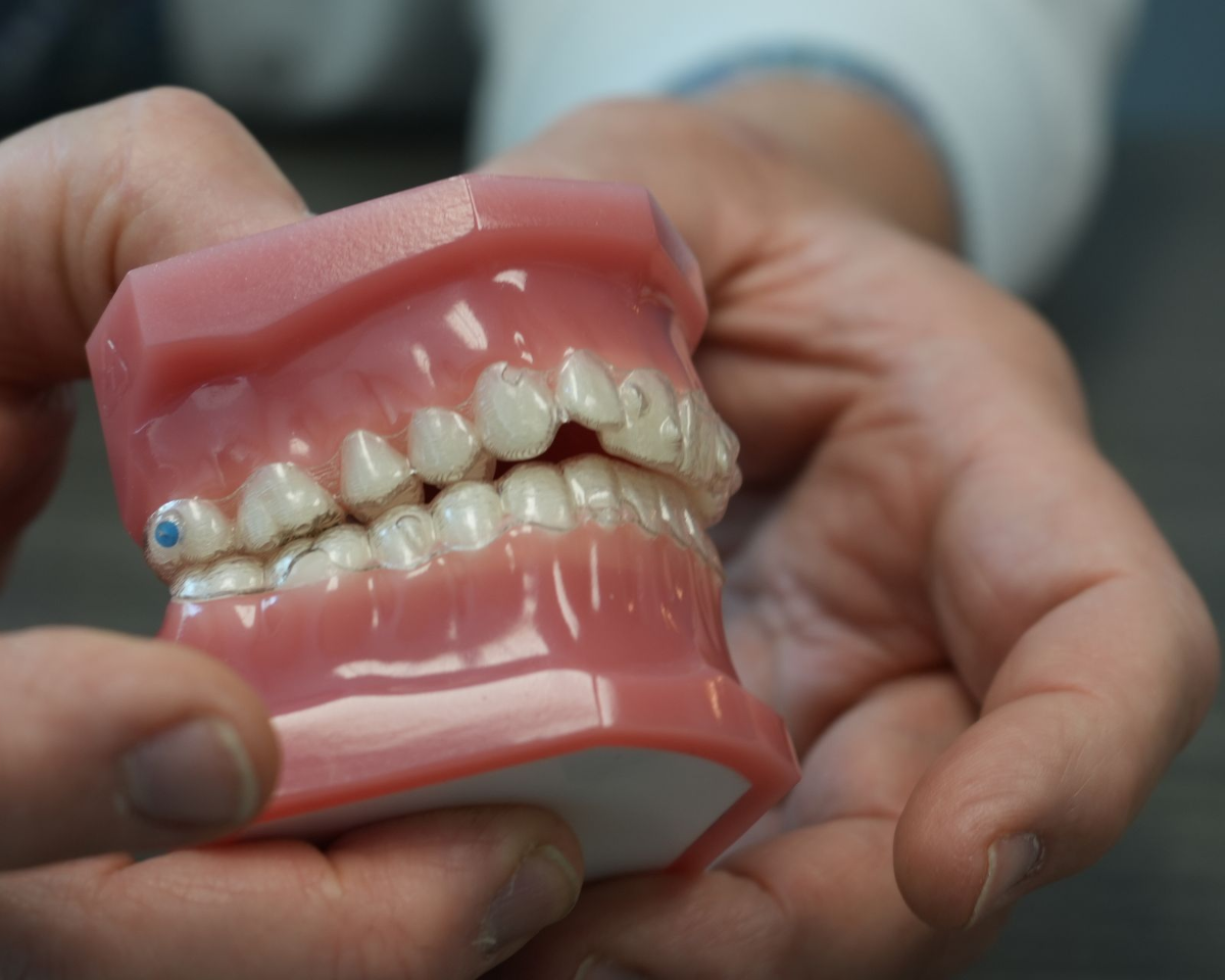 Hands holding a model of teeth with clear aligners, demonstrating teeth straightening.