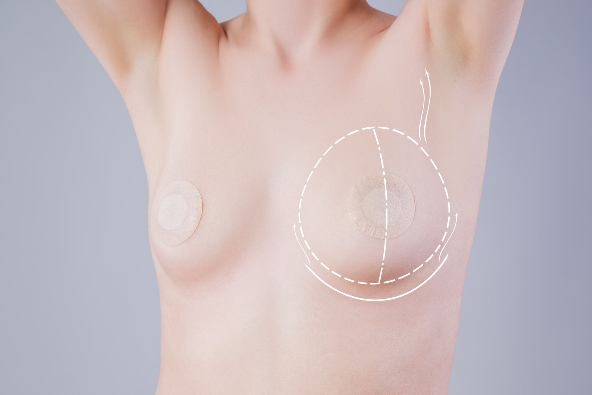 Benefits of Nipple Reconstruction Surgery