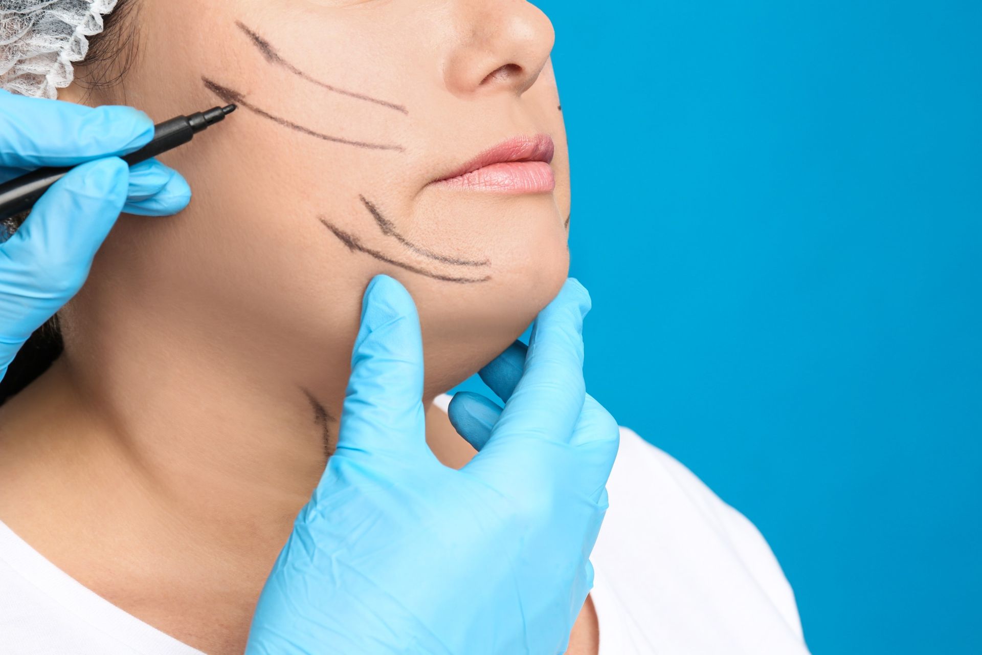 3 Signs You Need a Face and Neck Lift