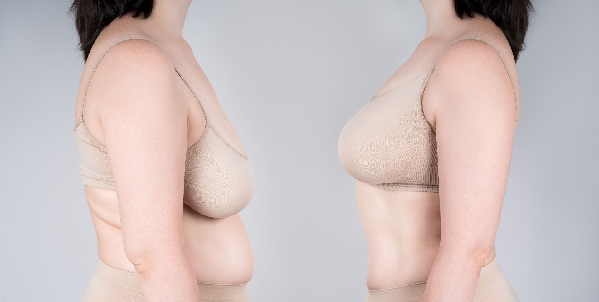 Breast Augmentation and Breast Lift combination benefits