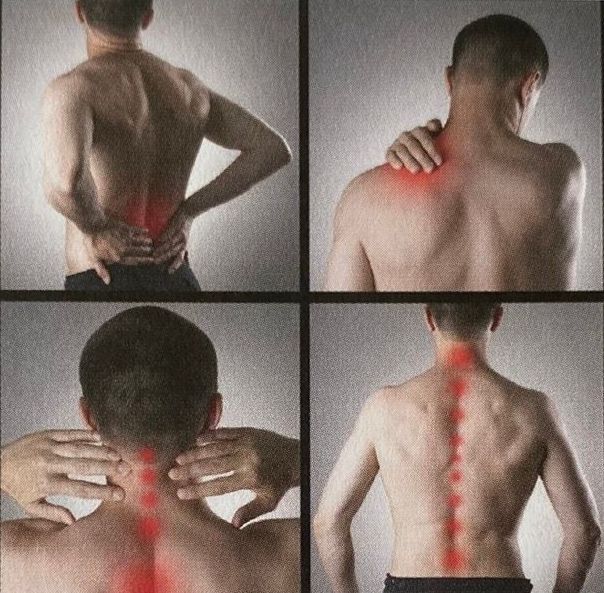 Quatre photos du dos et du cou d'un homme avec des taches rouges